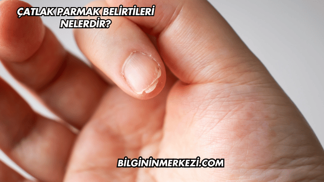 Çatlak Parmak Belirtileri Nelerdir?