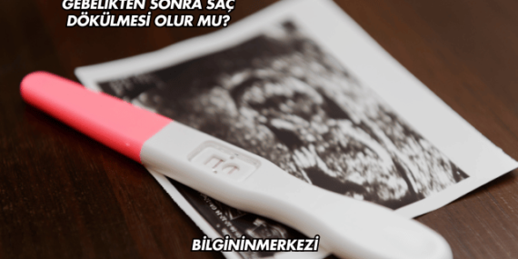 Gebelikten Sonra Saç Dökülmesi Olur mu?