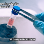 Kök Hücre ile Körlük Tedavisi