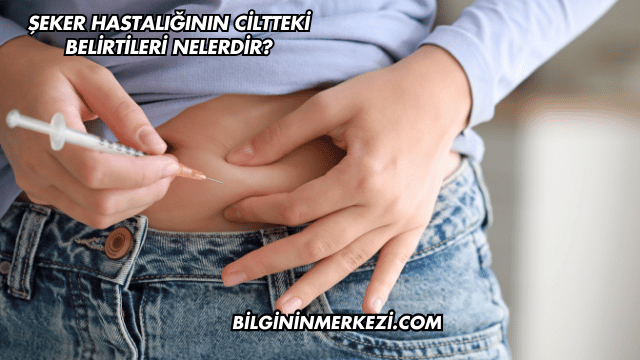 Şeker Hastalığının Ciltteki Belirtileri Nelerdir?
