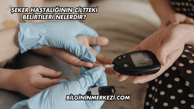 Şeker Hastalığının Ciltteki Belirtileri Nelerdir?