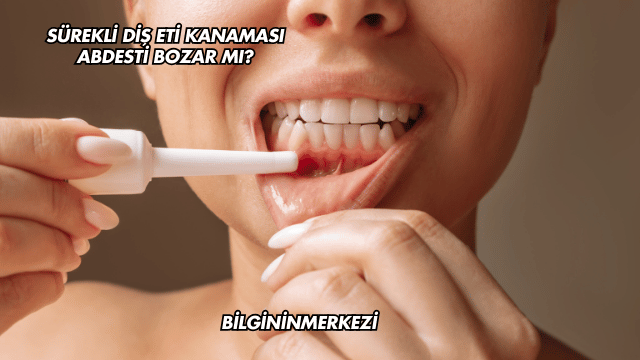 Sürekli Diş Eti Kanaması Abdesti Bozar mı?