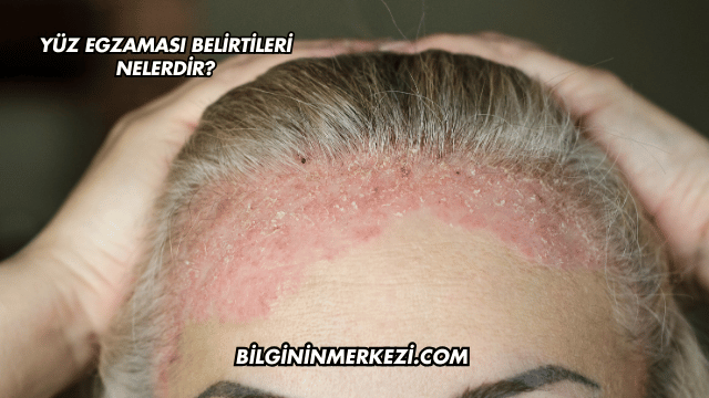 Yüz Egzaması Belirtileri Nelerdir?