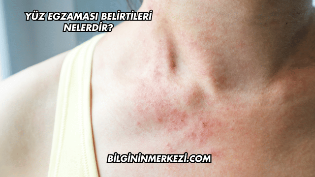 Yüz Egzaması Belirtileri Nelerdir?