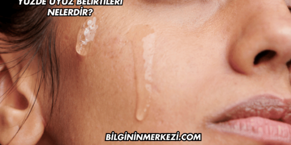 Yüzde Uyuz Belirtileri Nelerdir?