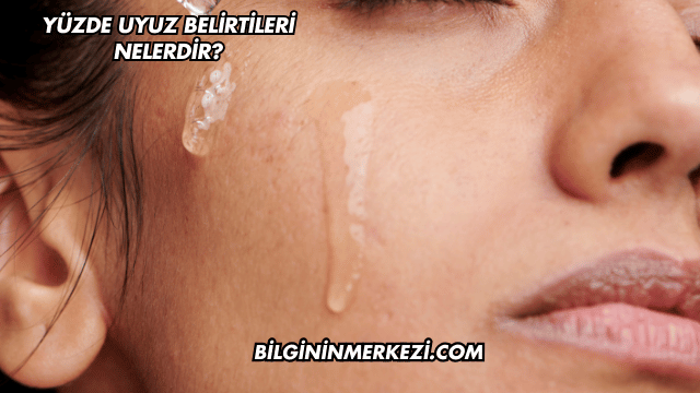 Yüzde Uyuz Belirtileri Nelerdir?