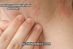Yüzdeki Egzama Belirtileri Nelerdir?