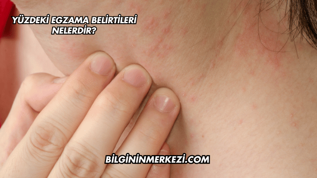 Yüzdeki Egzama Belirtileri Nelerdir?