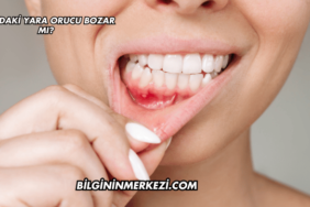 Ağızdaki Yara Orucu Bozar mı?