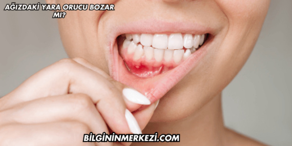 Ağızdaki Yara Orucu Bozar mı?