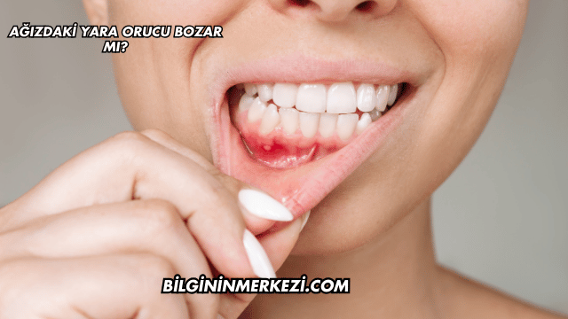 Ağızdaki Yara Orucu Bozar mı?