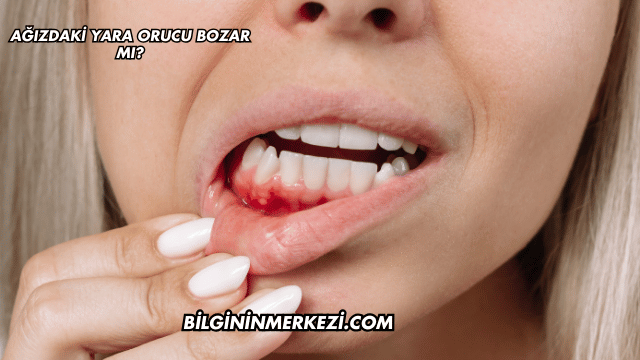 Ağızdaki Yara Orucu Bozar mı?
