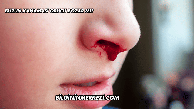 Burun Kanaması Orucu Bozar mı?