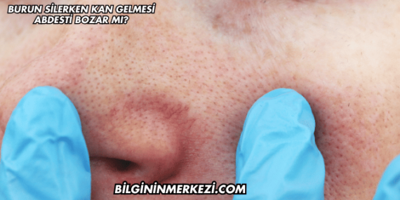 Burun Silerken Kan Gelmesi Abdesti Bozar mı?