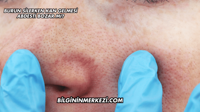 Burun Silerken Kan Gelmesi Abdesti Bozar mı?