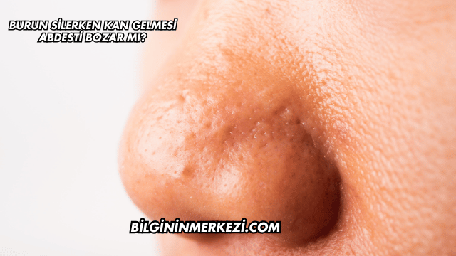 Burun Silerken Kan Gelmesi Abdesti Bozar mı?