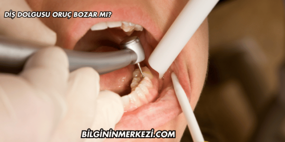 Diş Dolgusu Oruç Bozar mı?