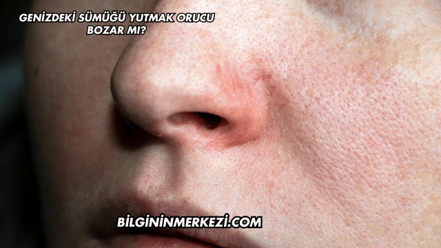 Genizdeki Sümüğü Yutmak Orucu Bozar mı?
