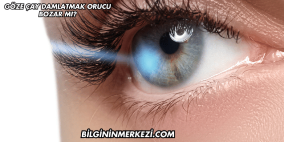 Göze Çay Damlatmak Orucu Bozar mı?