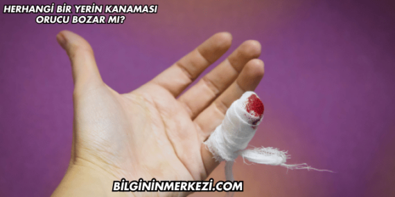 Herhangi Bir Yerin Kanaması Orucu Bozar mı?
