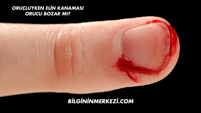Oruçluyken Elin Kanaması Orucu Bozar mı?