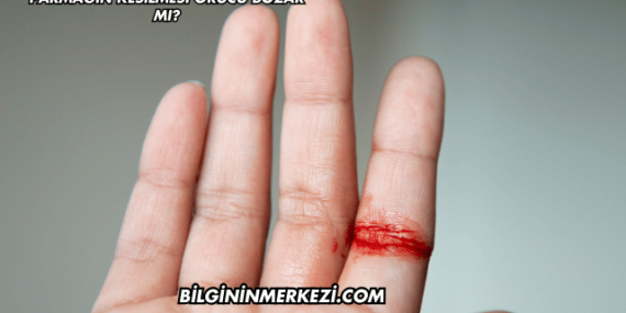 Parmağın Kesilmesi Orucu Bozar mı?