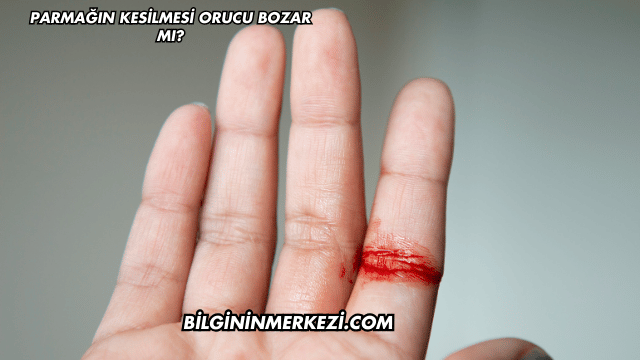 Parmağın Kesilmesi Orucu Bozar mı?