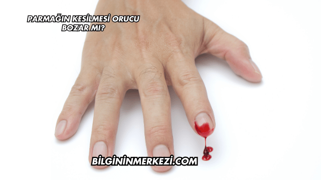 Parmağın Kesilmesi Orucu Bozar mı?