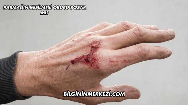 Parmağın Kesilmesi Orucu Bozar mı?