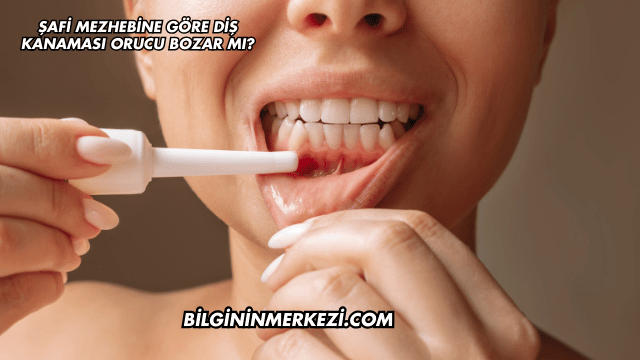 Şafi Mezhebine Göre Diş Kanaması Orucu Bozar mı?