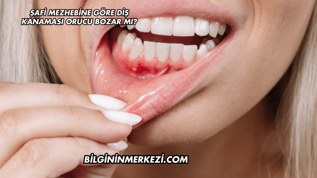 Şafi Mezhebine Göre Diş Kanaması Orucu Bozar mı?