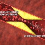 Yüksek Kolesterolün Belirtileri Nelerdir?