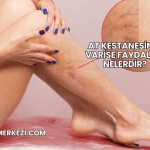 At Kestanesinin Varise Faydaları Nelerdir?