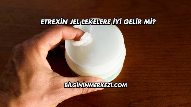 Etrexin Jel Lekelere İyi Gelir mi?