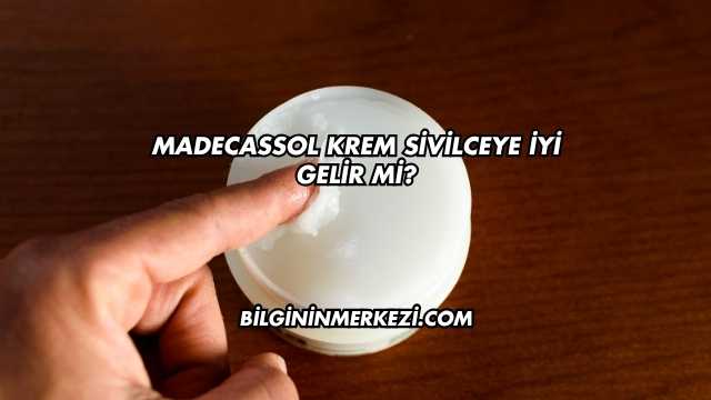 Madecassol Krem Sivilceye İyi Gelir mi?