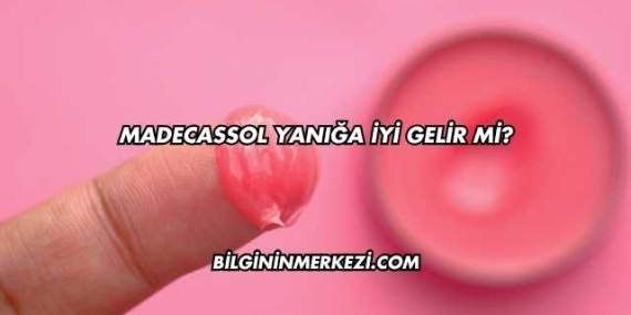 Madecassol Yanığa İyi Gelir mi?