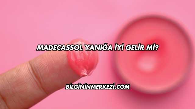 Madecassol Yanığa İyi Gelir mi?