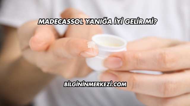 Madecassol Yanığa İyi Gelir mi?
