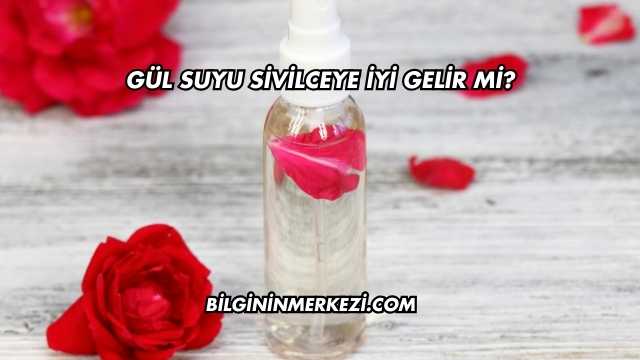 Gül Suyu Sivilceye İyi Gelir mi