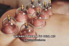 Hacamat Nazara İyi Gelir mi?