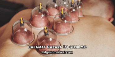 Hacamat Nazara İyi Gelir mi?